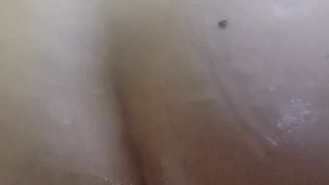 Anal Prolapse Taurina Cam
